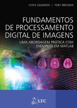 Fundamentos de processamento digital de imagens: Uma abordagem prática com exemplos em Matlab