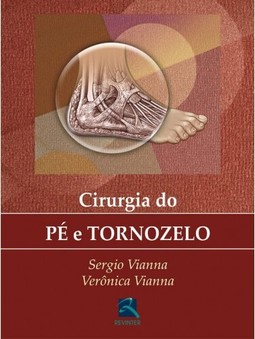 Cirurgia do Pé e Tornozelo