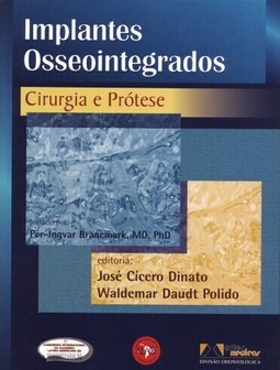 Implantes Osseointegrados