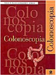 Colonoscopia