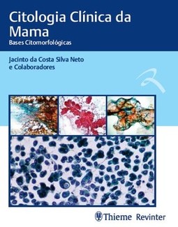 Citologia clínica da mama: bases citomorfológicas
