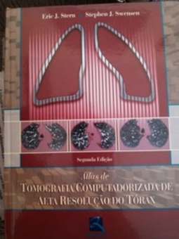 Atlas de Tomografia Computadorizada de Alta Resolução do Tórax