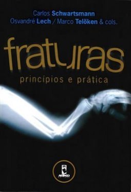 PRINCIPIOS AO DO TRATAMENTO DE FRATURAS
