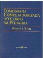 Tomografia Computadorizada do Corpo em Pediatria