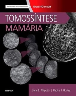 Tomossíntese mamária