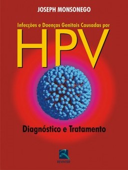 Infecções e doenças genitais causadas por HPV: diagnóstico e tratamento