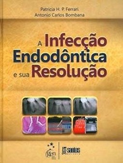 A infecção endodôntica e sua resolução