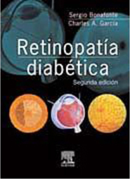 Retinopatía Diabética - Importado