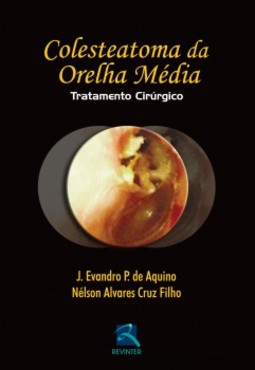 Colesteatoma da orelha média: tratatamento cirúrgico