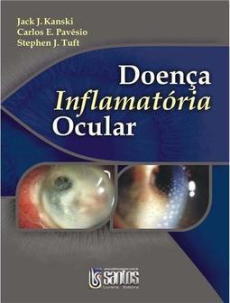 Doença Inflamatória Ocular