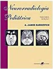 Neurorradiologia Pediátrica