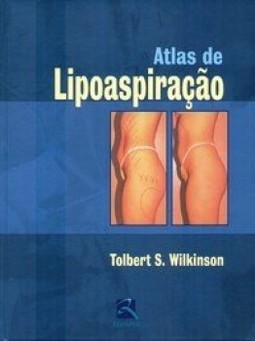 Atlas de lipoaspiração: manual prático