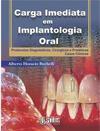 Carga Imediata em Implantologia Oral