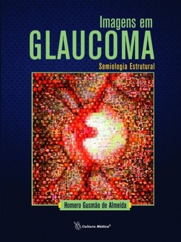 Imagens em glaucoma: semiologia estrutural