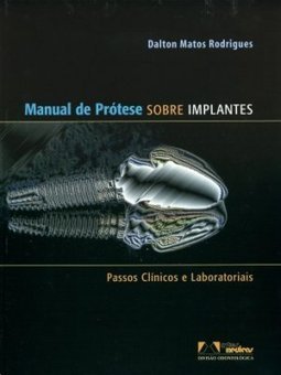 Manual de Prótese Sobre Implantes