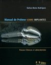 Manual de Prótese Sobre Implantes
