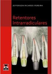 Retentores Intrarradiculares