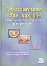 Overdentures Sobre Implantes: Critérios de Cuidados para Pacientes...
