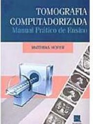 Tomografia Computadorizada: Manual Prático de Ensino