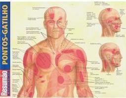 Pontos-Gatilho