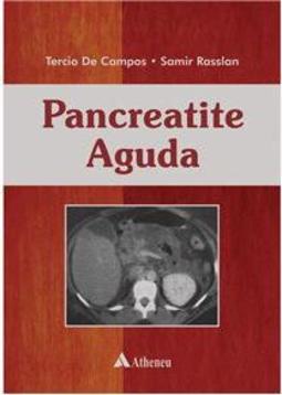 Pancreatite Aguda