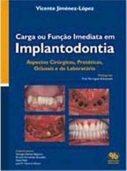 Carga ou função imediata em implantodontia
