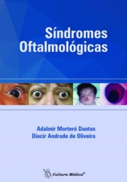 Síndromes oftalmológicas