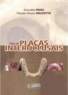 Atlas de Placas Interoclusais