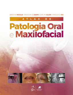 Atlas de patologia oral e maxilofacial