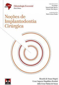 Noções de Implantodontia Cirúrgica