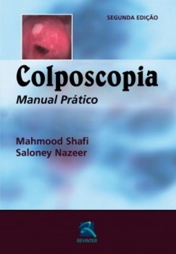 Colposcopia: manual prático