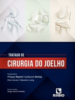Tratado de cirurgia do joelho