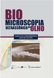 Biomicroscopia Ultrassônica do Olho