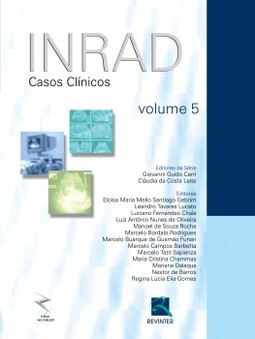 INRAD: casos clínicos