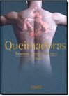 Queimaduras: Tratamento Clínico e Cirúrgico