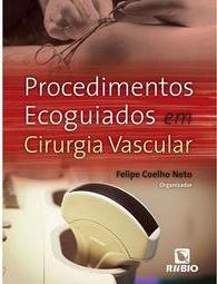 Procedimentos ecoguiados em cirurgia vascular