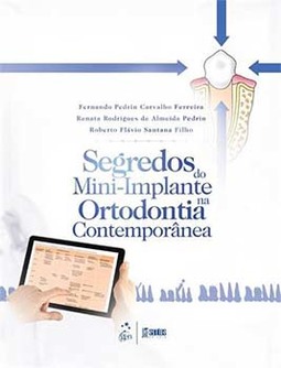 Segredos do mini-implante na ortodontia contemporânea