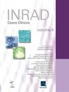 INRAD: casos clínicos