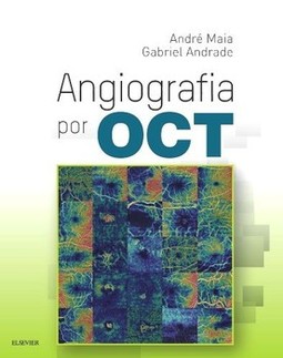 Angiografia por OCT