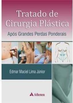 Tratado de cirurgia plástica após grandes perdas ponderais