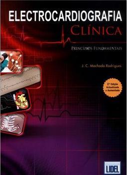 Electrocardiografia Clínica