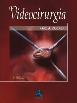 Videocirurgia