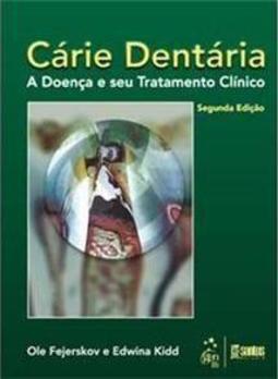 Cárie dentária: A doença e seu tratamento clínico