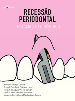 Recessão periodontal: tratamento cirúrgico