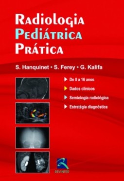 Radiologia pediátrica prática