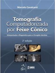 Tomografia Computadorizada por Feixe Cônico