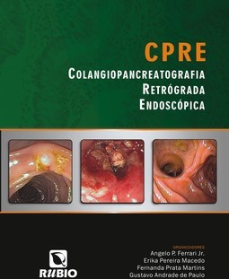 CPRE – Colangiopancreatografia retrógrada endoscópica