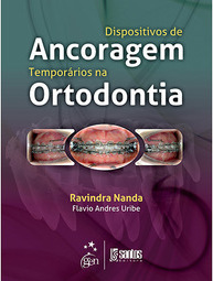 Dispositivos de Ancoragem Temporários na Ortodontia