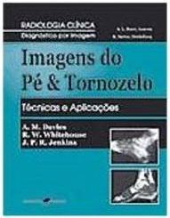 Imagens do Pé e Tornozelo Técnicas e Aplicações