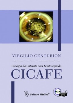 Cirurgia da catarata com femtosegundo (CICAFE)